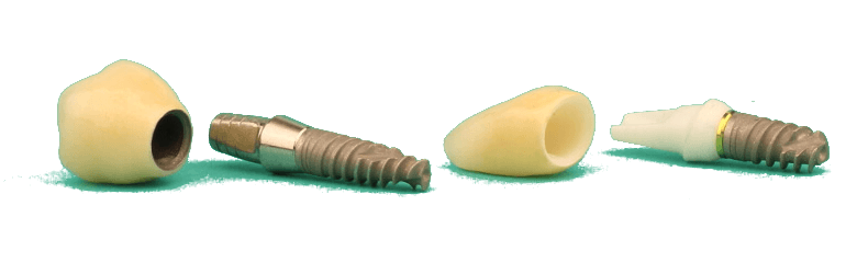 Zahnimplantate in Ungarn